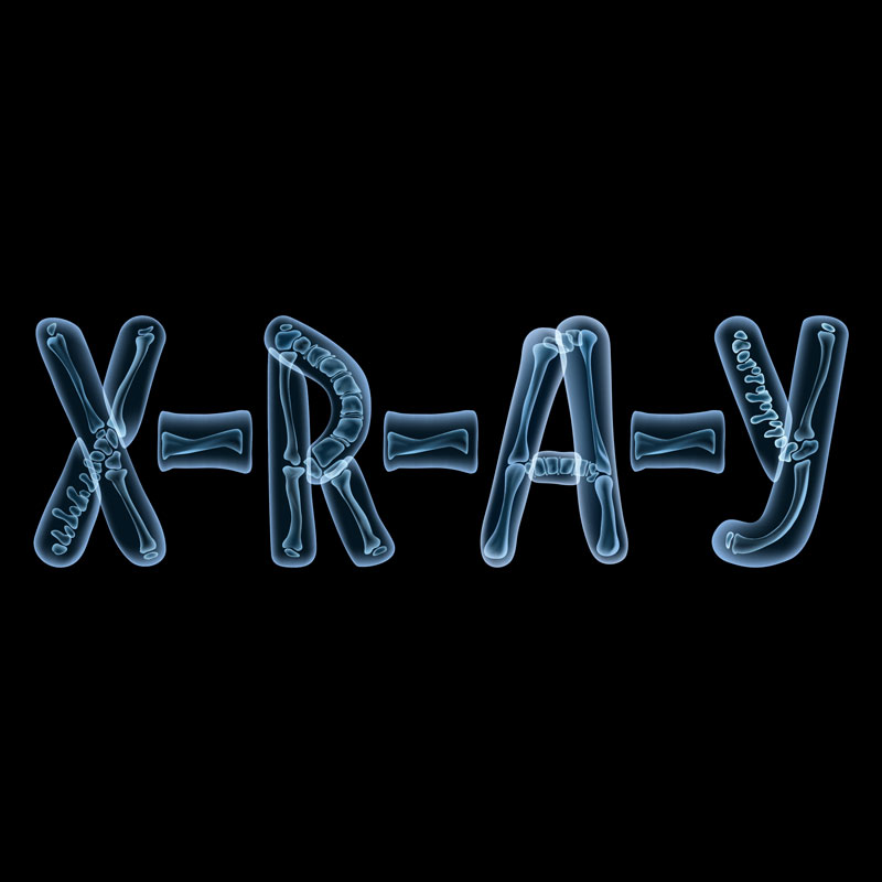 Submissions XRAY