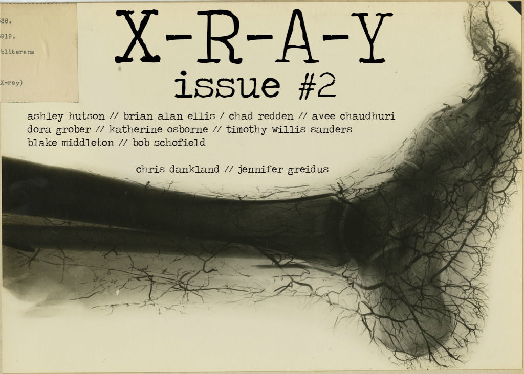 X-R-A-Y ISSUE #2