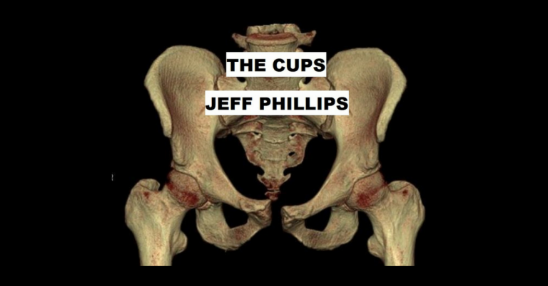 jeff phillips
