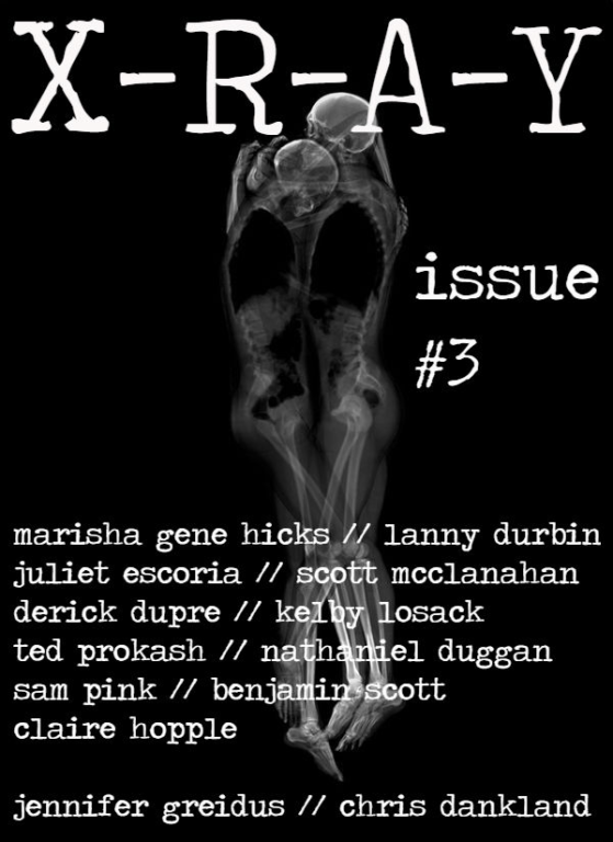 X-R-A-Y ISSUE #3