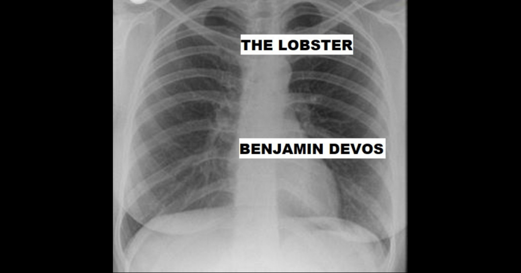THE LOBSTER by Benjamin DeVos