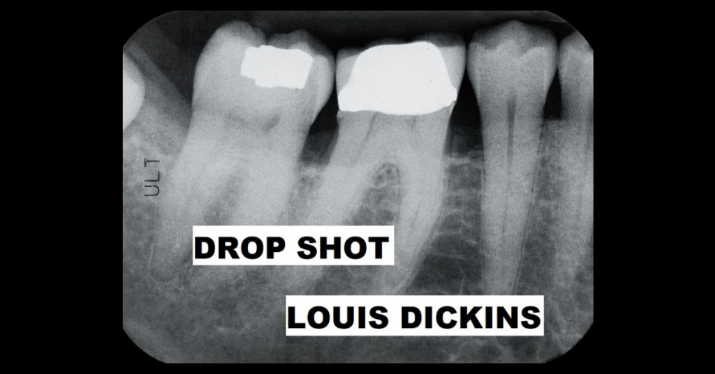 DROP SHOT by Louis Dickins