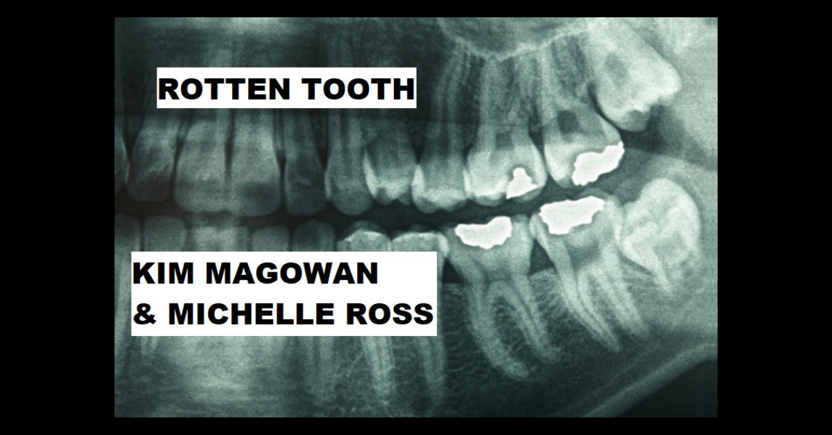 why-does-a-rotten-tooth-smell-causes-consequences